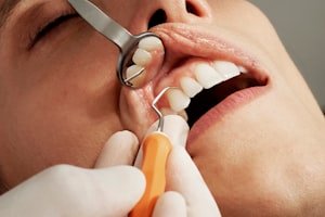 طبيب أسنان يفحص أسنان مريض كجزء من الفحص الدوري لصحة الفم